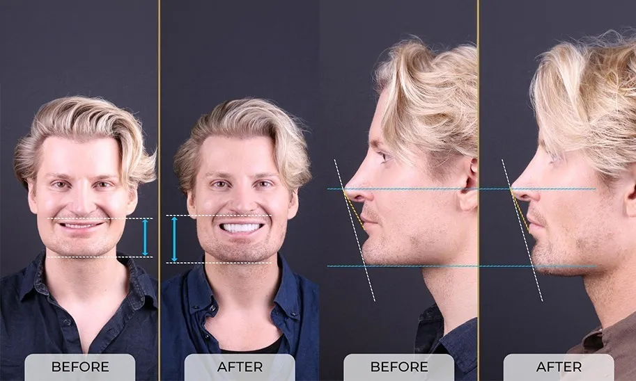 Revolutionize Your Dental Care with Digital Dentistry