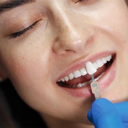 Comprehensive Care with Holistic Dentistry