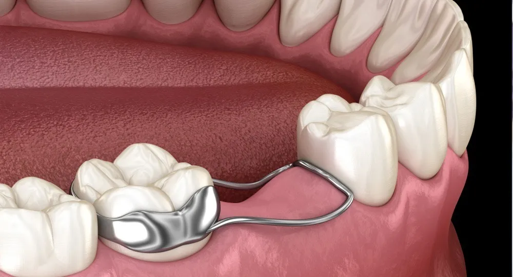 Advanced Prosthesis Solutions in Dentistry